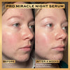 Revolution Pro Miracle Night Serum, imported from the UK
