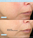 NuFACE Trinity+ Eye and Lip Set microcurrent device, UK version