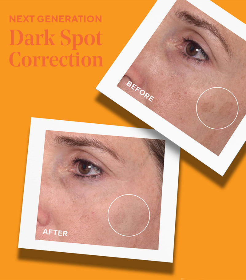 Murad rapid dark spot correcting serum 30ml, imported from the UK