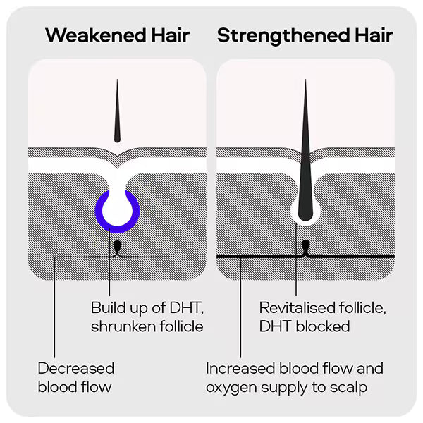 Sons Shampoo for Male Pattern Hair Loss 200ml (British brand)