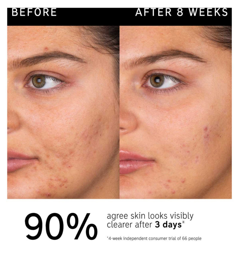 The INKEY List Salicylic Acid Cleanser 150ml (British brand)