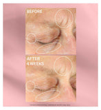 StriVectin Intensive Eye Concentrate Plus anti-wrinkle eye cream - British product