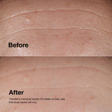 Clinique wrinkle correcting serum 50ml - British product