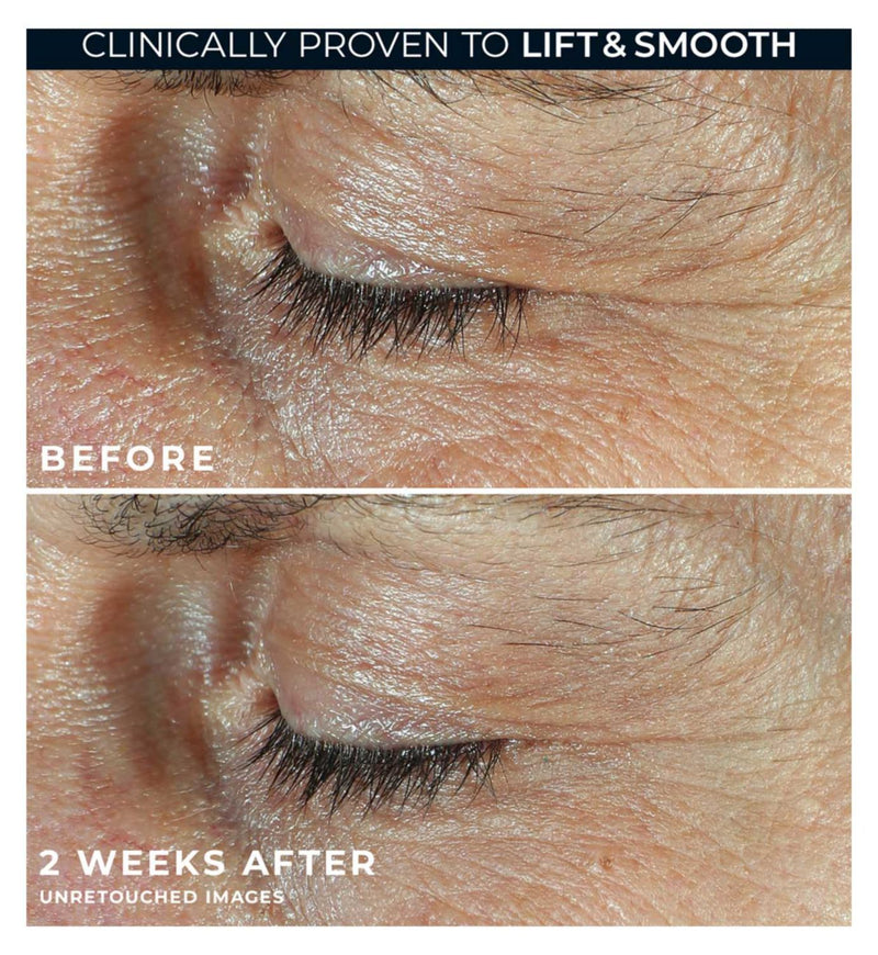RoC Derm Correxion dual eye cream 20ml, imported from the UK