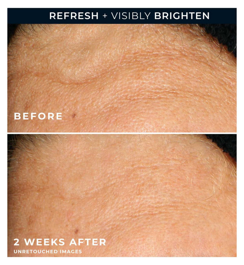 RoC Multi Correxion Vitamin C gel cleanser 177ml, imported from the UK