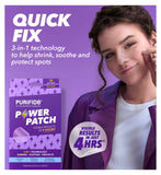 Acnecide acne treatment bundle with gel and patches - British product