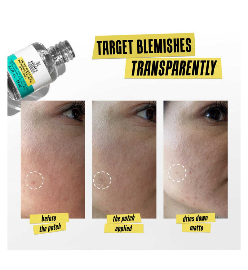 Kiehl's Truly Targeted Blemish-Clearing Solution 15ml, UK version