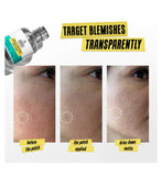 Kiehl's Truly Targeted Blemish-Clearing Solution 15ml, UK version
