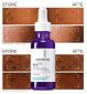 La Roche-Posay MelaB3 Serum dark spot treatment 30ml, imported from the UK