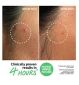 The INKEY List pimple patches 22 count (British brand)