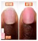 Essie Nail Repair Kit bundle with nail and cuticle treatments - British product