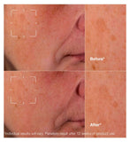 Clinique dark spot clearing serum 50ml - British product