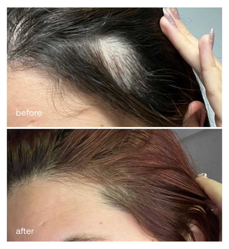 UKHAIR Hair Growth Serum 50ml, imported from the UK