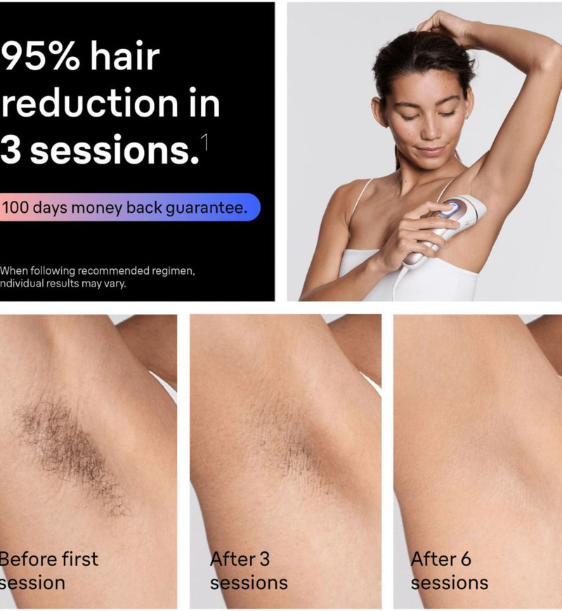 Braun Smart IPL hair removal device with app, UK version