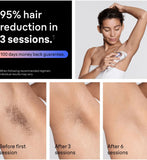 Braun Smart IPL hair removal device with app, UK version