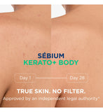 Bioderma Sebium Kerato+ body spray 150ml, UK version