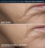 RoC Retinol Correxion Deep Wrinkle Cream 50ml - British product