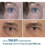 Dr.Melaxin Eyebag Cream 10ml eye bag cream, UK version
