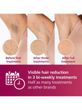 Philips Lumea 7000 IPL hair removal device white, imported from the UK