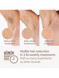 Philips Lumea 8000 Series IPL hair removal device white, imported from the UK