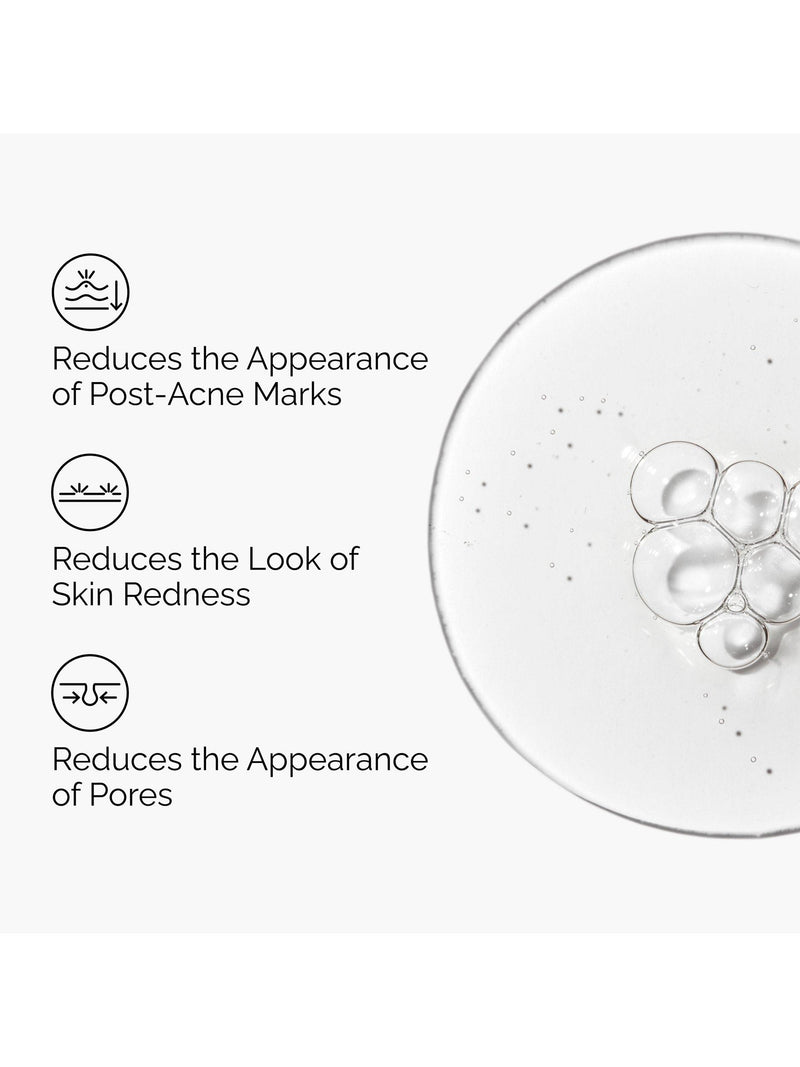 The Ordinary Aloe 2% NAG serum 30ml (British brand)