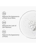 The Ordinary Aloe 2% NAG serum 30ml (British brand)