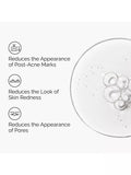 The Ordinary Aloe 2% NAG serum 30ml (British brand)
