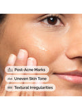 The Ordinary Aloe 2% NAG serum 30ml (British brand)