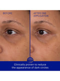 Augustinus Bader hydrogel eye patches 6 sachets, imported from the UK