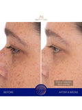 Augustinus Bader hydrogel eye patches 6 sachets, imported from the UK