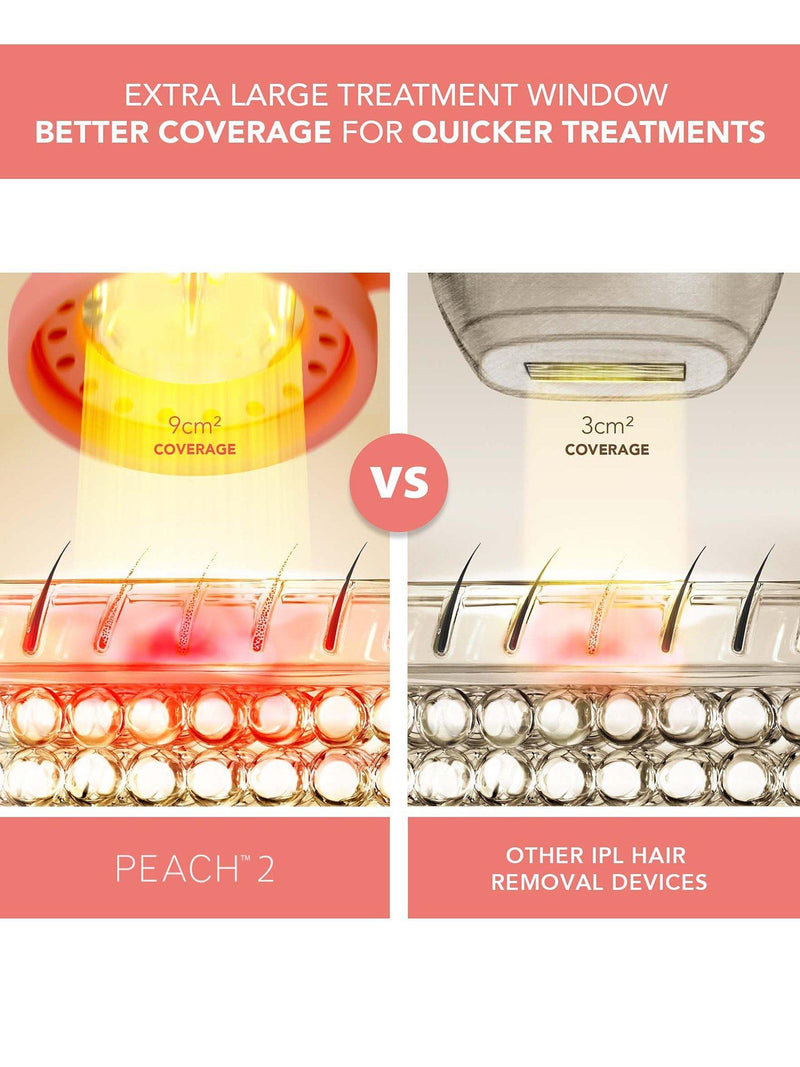 FOREO PEACH 2 IPL hair removal device (British brand)