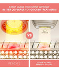 FOREO PEACH 2 IPL hair removal device (British brand)