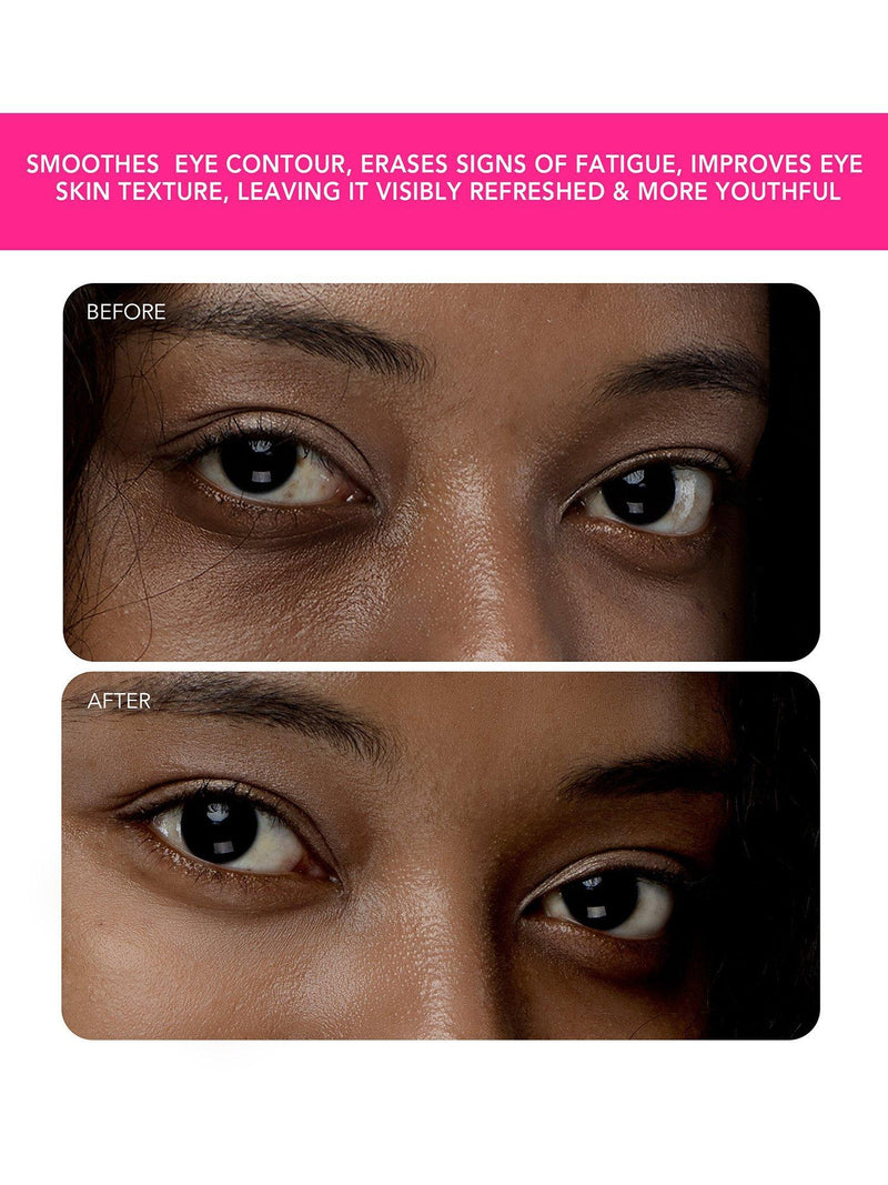 FOREO IRIS 2 eye massager in Fuchsia, imported from the UK
