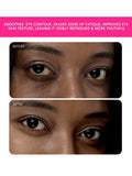 FOREO IRIS 2 eye massager in Fuchsia, imported from the UK