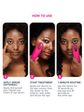 FOREO IRIS 2 eye massager in Fuchsia, imported from the UK