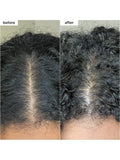 Briogeo Scalp Revival Charcoal + Coconut Oil Shampoo 236ml (British brand)