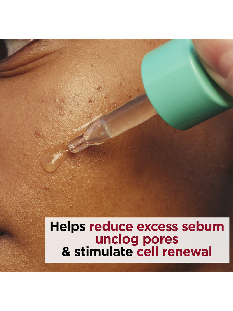 Clarins resurfacing blemish serum 30ml, UK version