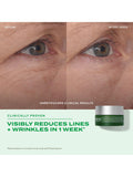 Murad Retinal ReSculpt Eye Treatment 15ml, imported from the UK