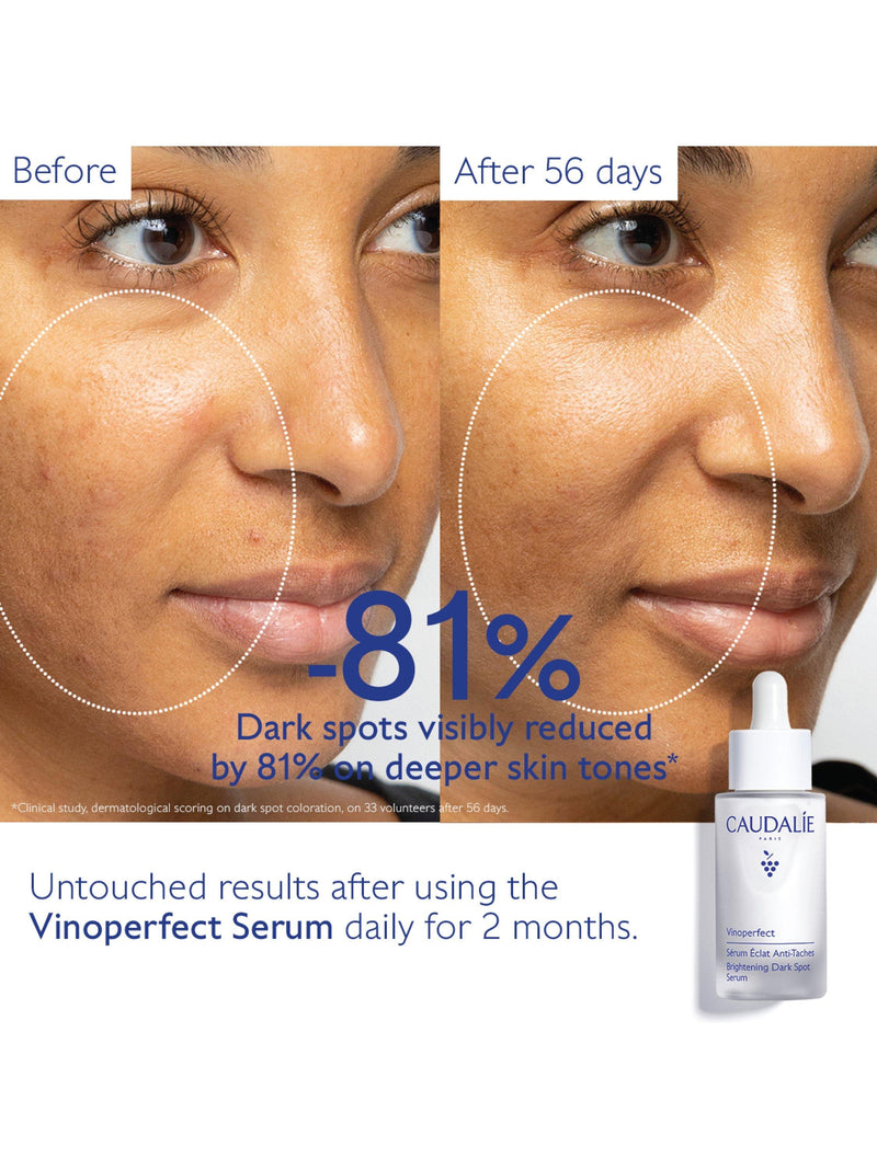 Caudalie Vinoperfect dark spot serum 30ml (British brand)