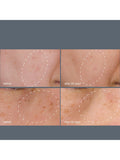 Dermalogica dark spot treatment system with serum and peel - British product