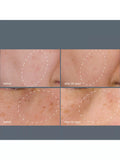 Dermalogica dark spot treatment system with serum and peel - British product