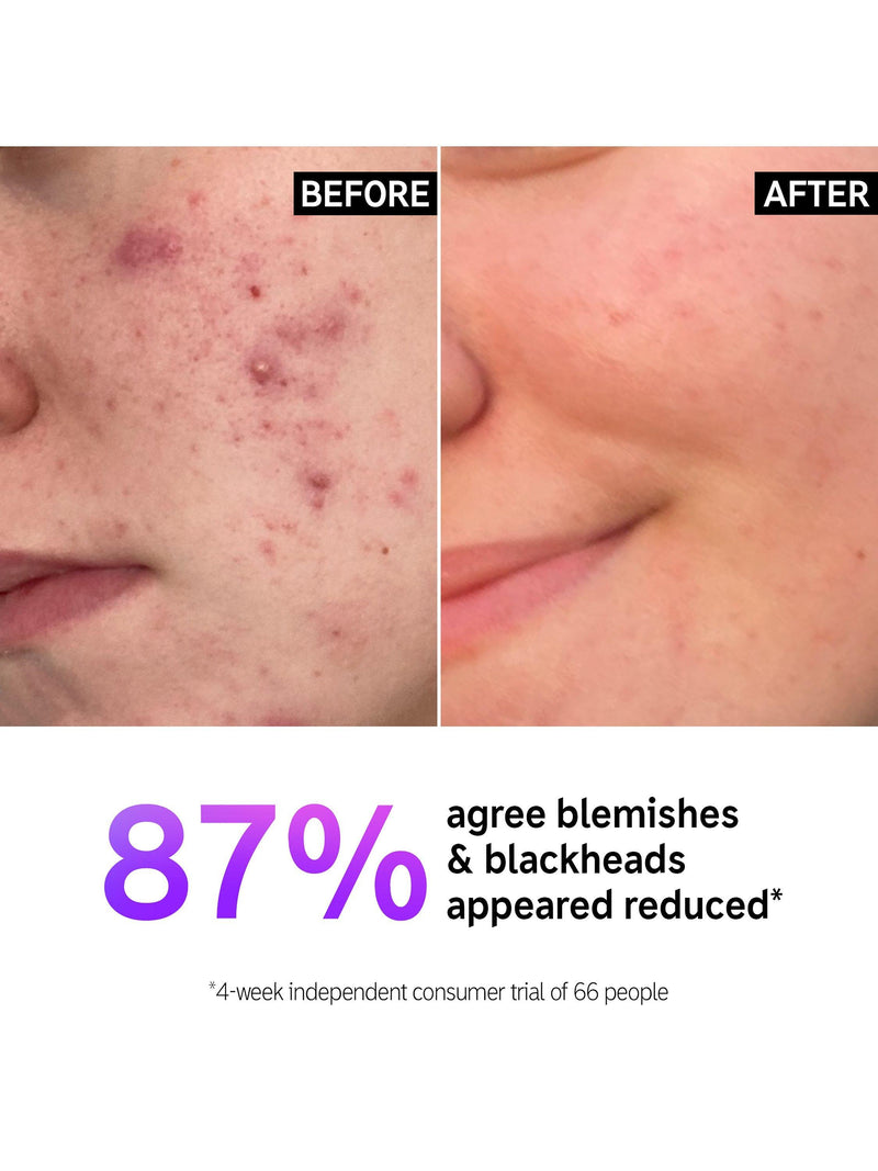 The INKEY List Salicylic Acid Gel Cleanser for Blemish-Prone Skin (British brand)
