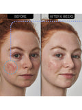 INKEY List Azelaic Acid Serum 30ml, imported from the UK