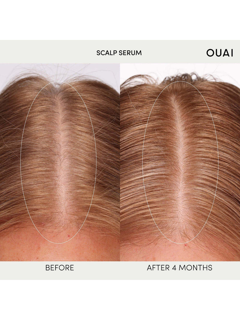 OUAI scalp serum 60ml, imported from the UK