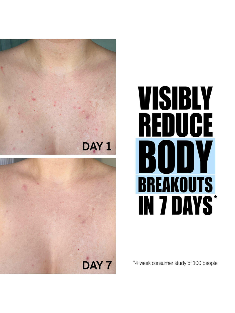 The INKEY List glycolic acid body stick 45g, imported from the UK