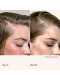 Living Proof scalp density serum 50ml - British product