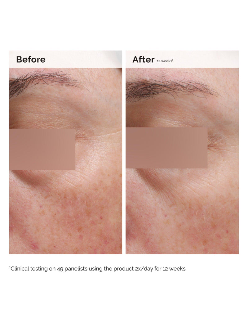 The Ordinary Niacinamide 5% Face and Body Emulsion 100ml (British brand)