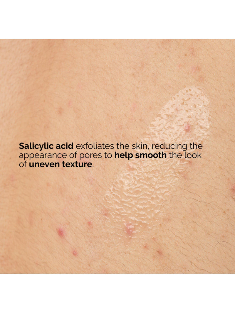 The Ordinary Salicylic Acid 0.5% Body Serum 240ml (British brand)