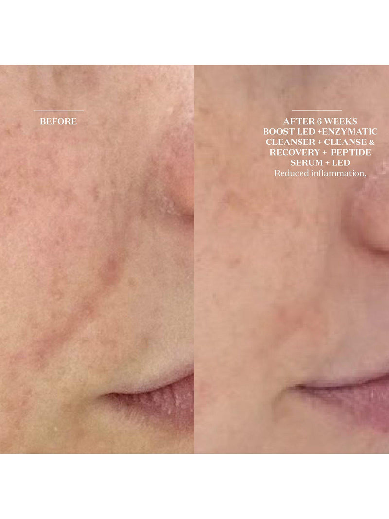 The Light Salon Enzymatic Cleanser & Mask 150ml, UK version
