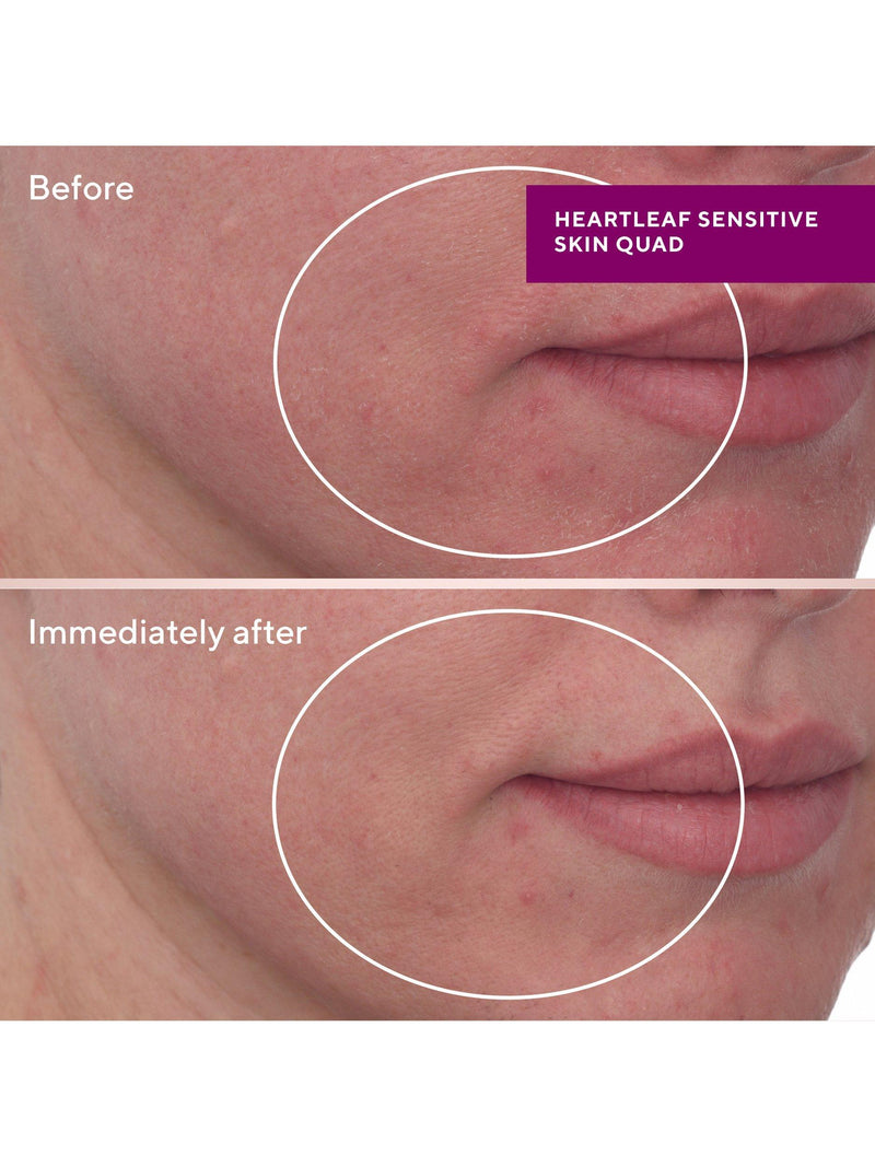 Murad Heartleaf Gentle Resurfacing Serum 30ml, imported from the UK